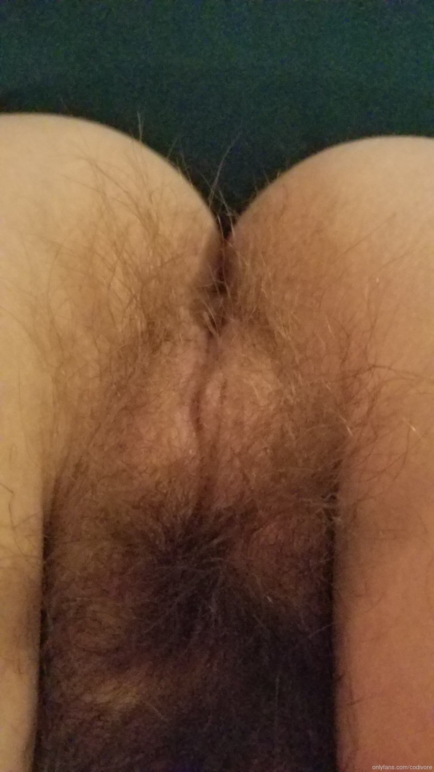 2651165